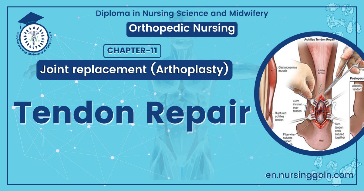 Tendon Repair | CHAPTER 11 | Orthopedic Nursing