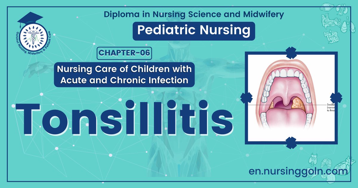 Definition of Tonsillitis | CHAPTER 6 | Pediatric Nursing