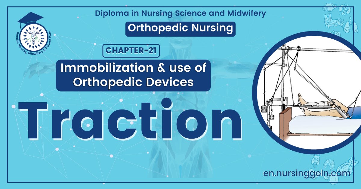 Defination of Traction | CHAPTER 21 | Orthopedic Nursing