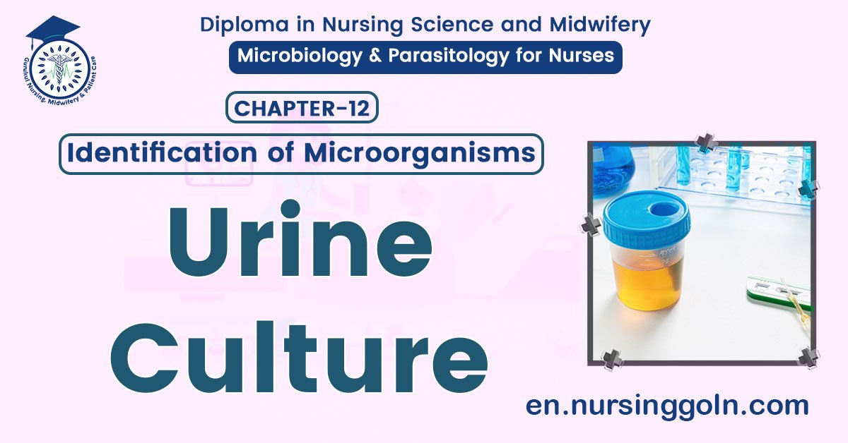 Concept about Urine Culture