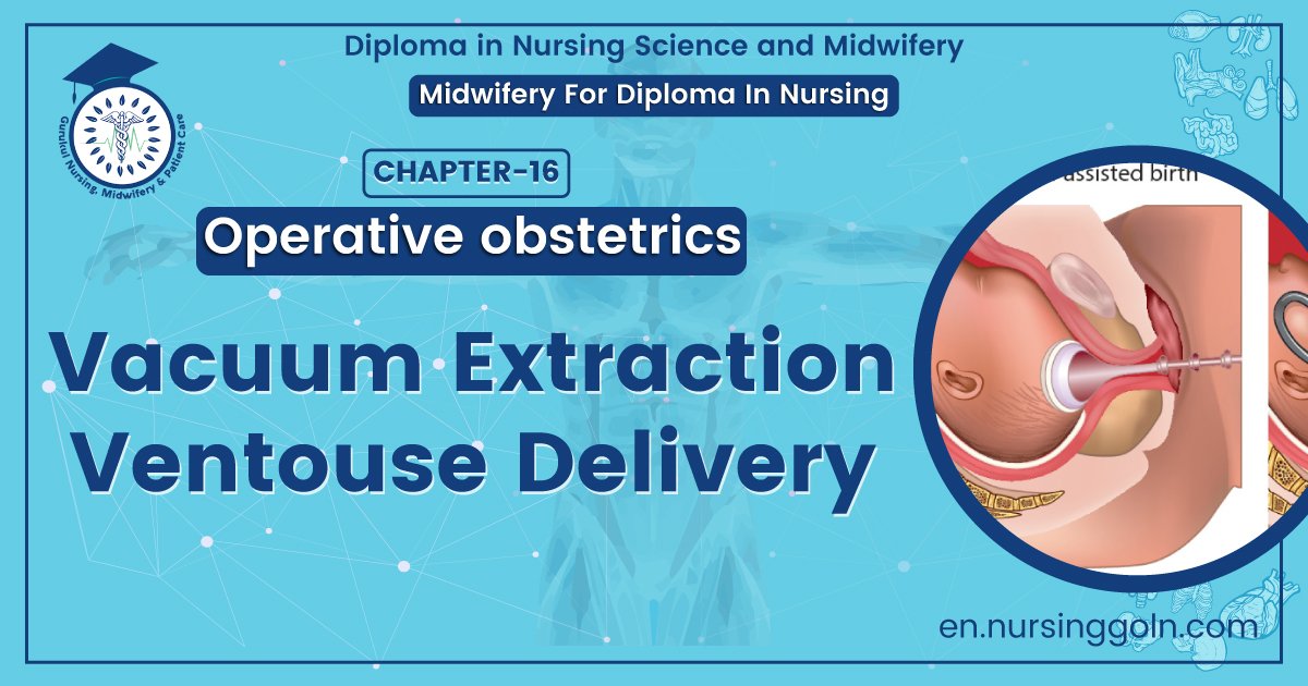 Vacuum extraction/ventouse delivery | Chapter 16 | Midwifery For Diploma In Nursing