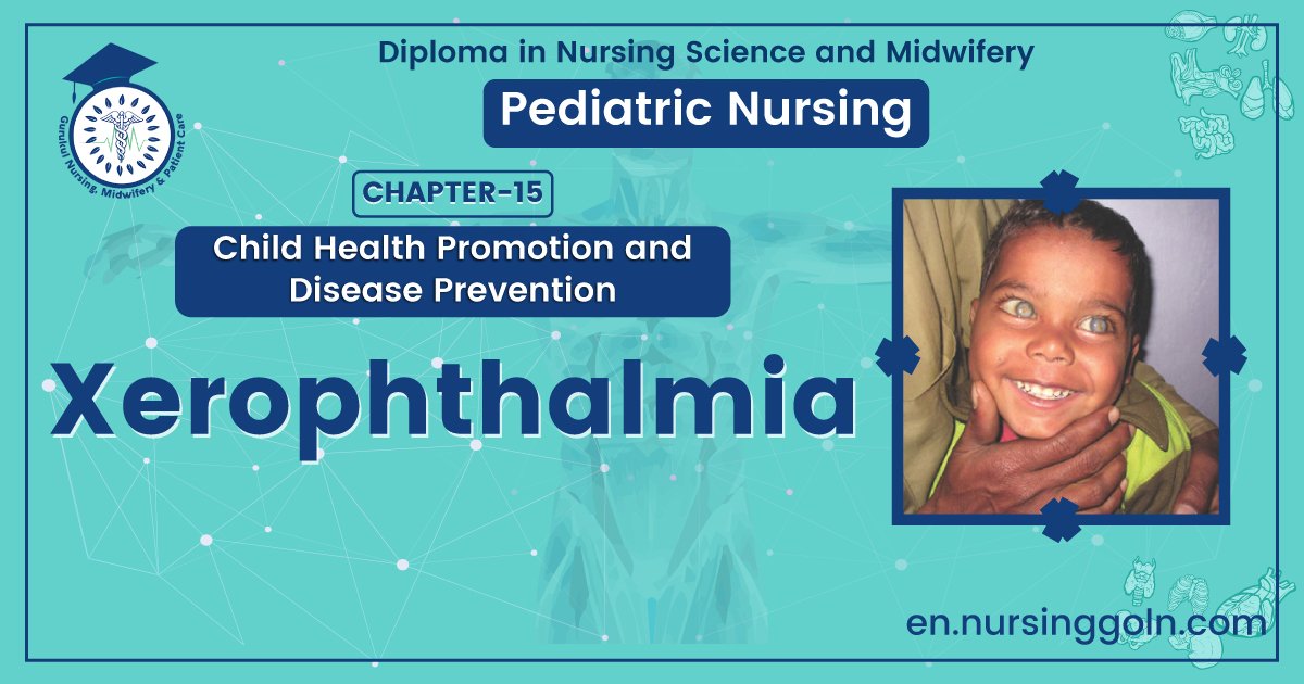 Concept about Xerophthalmia | CHAPTER 15 | Pediatric Nursing