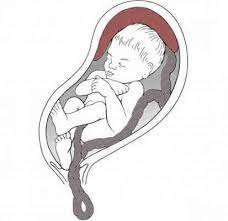 Cord Prolapse | Chapter 17 | Midwifery For Diploma In Nursing