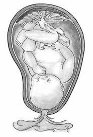 Premature Rupture Of Membrane (PROM) | Chapter 17 | Midwifery For Diploma In Nursing