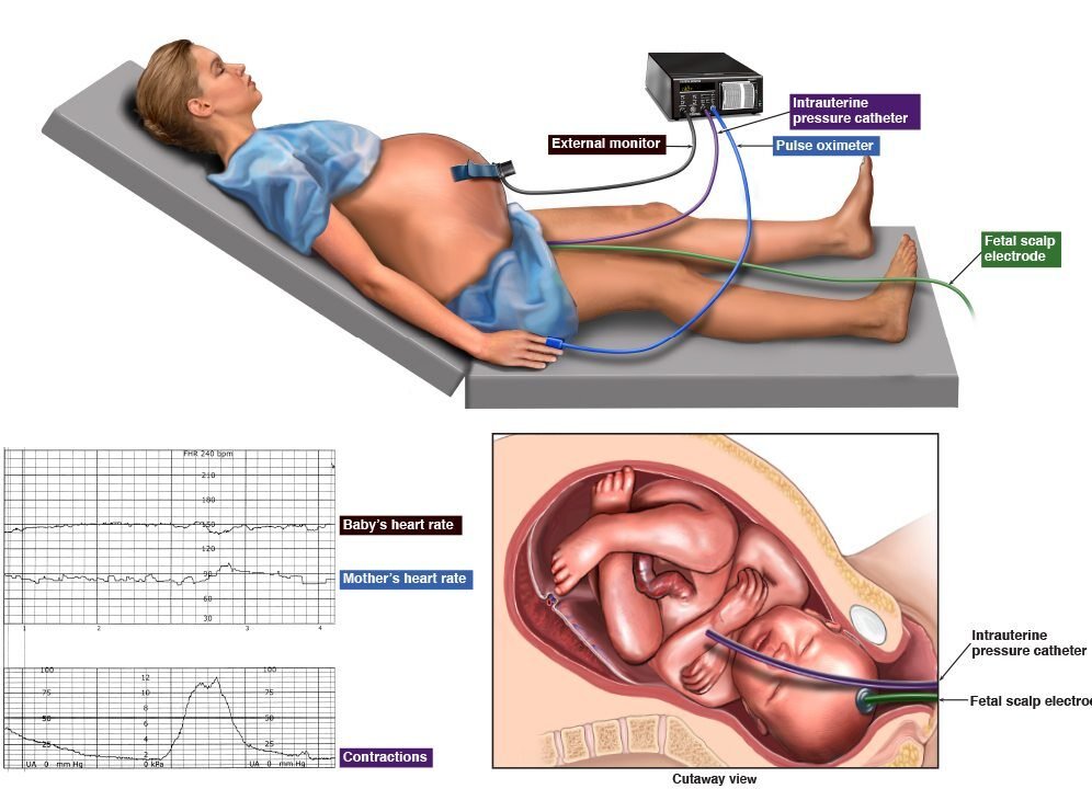 First Stage Of Labor | Chapter 13 | Midwifery For Diploma In Nursing