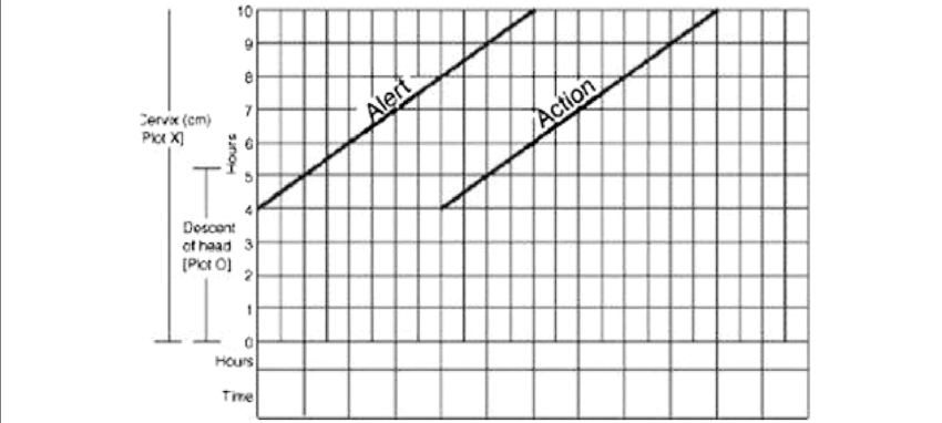 Definition of Partograph | Chapter 13 | Midwifery For Diploma In Nursing