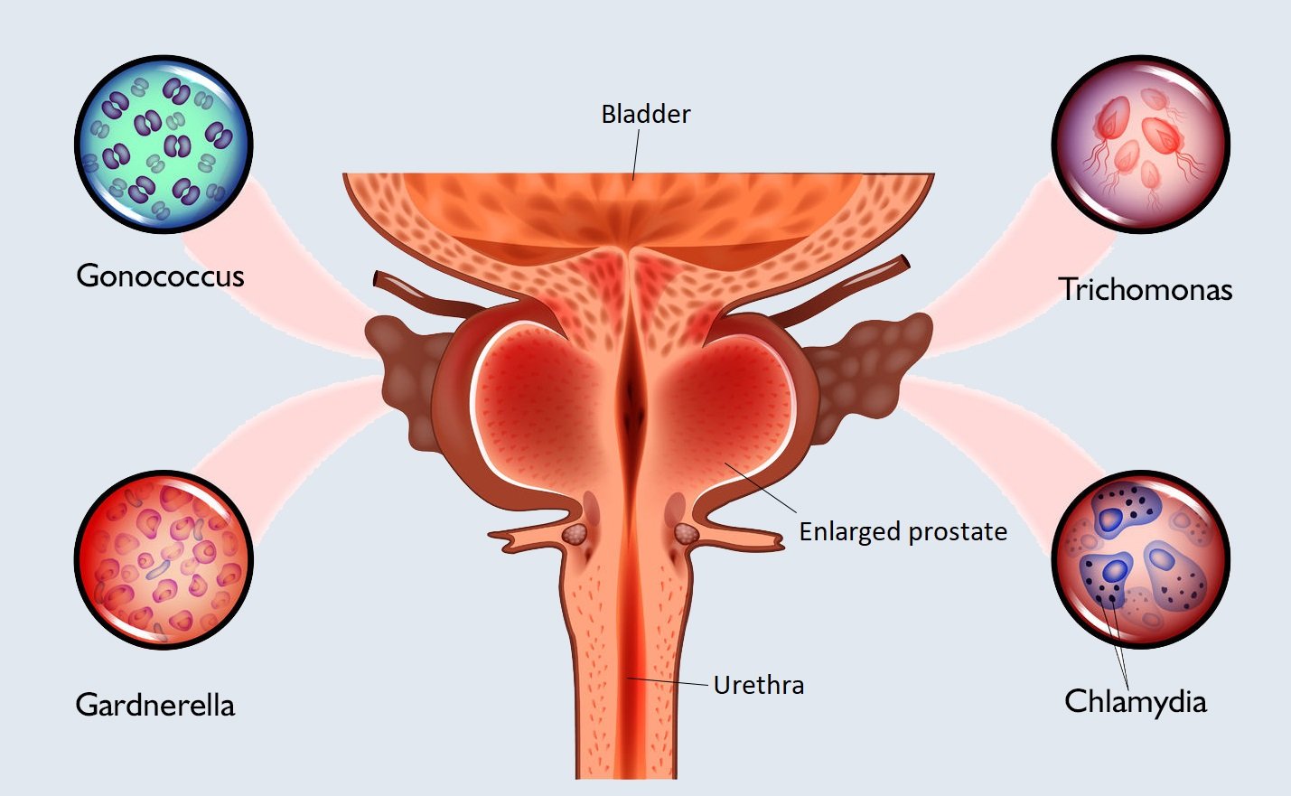 Sexually Transmitted Diseases (STDs) | Chapter 12 | Midwifery For Diploma In Nursing